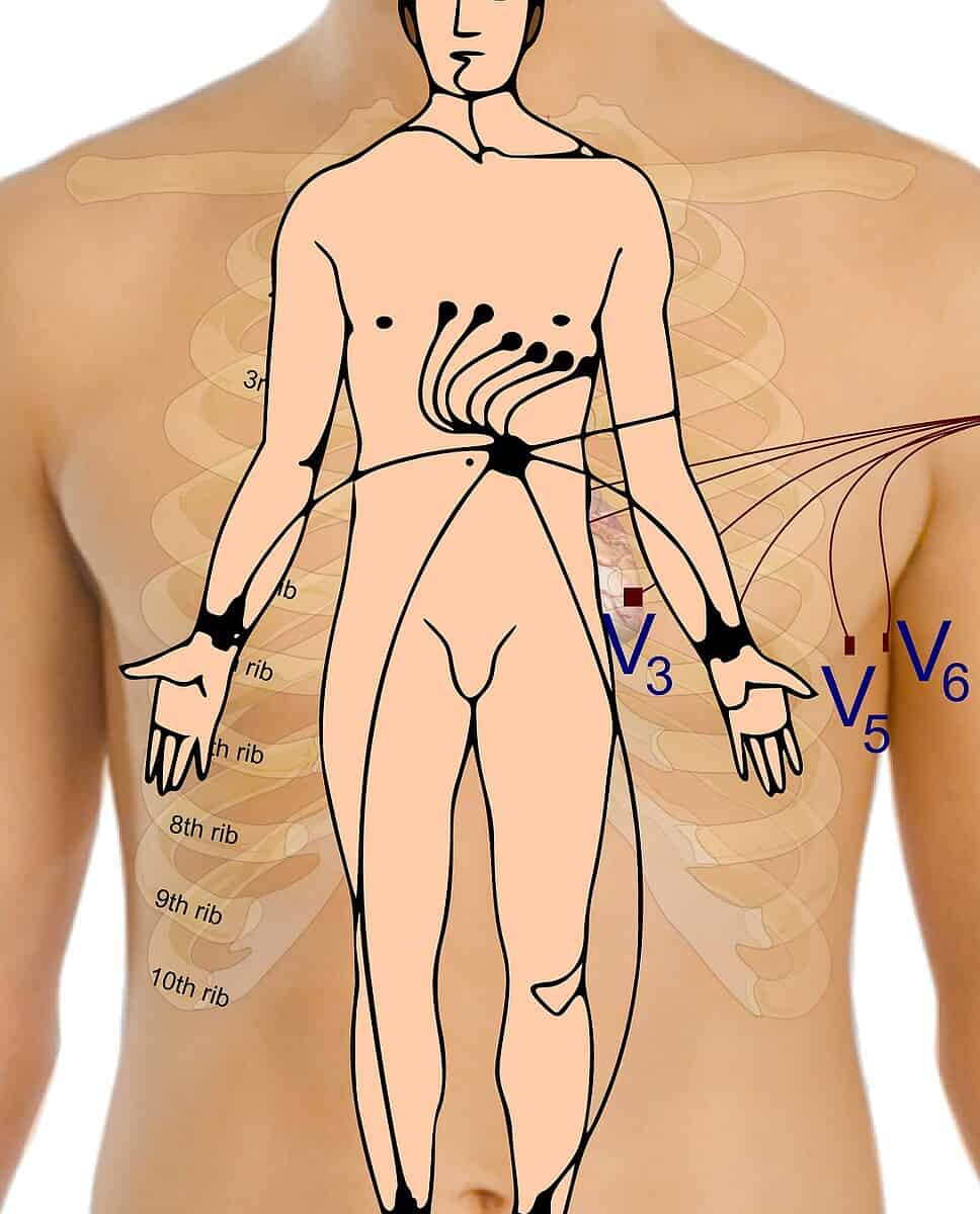 electrocardiogram, body, points-165962.jpg